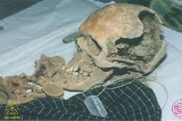 نحوه تشخیص پیکر شهید ایرانی از جسد عرقی نحوه تشخیص پیکر شهید ایرانی از جسد عرقی